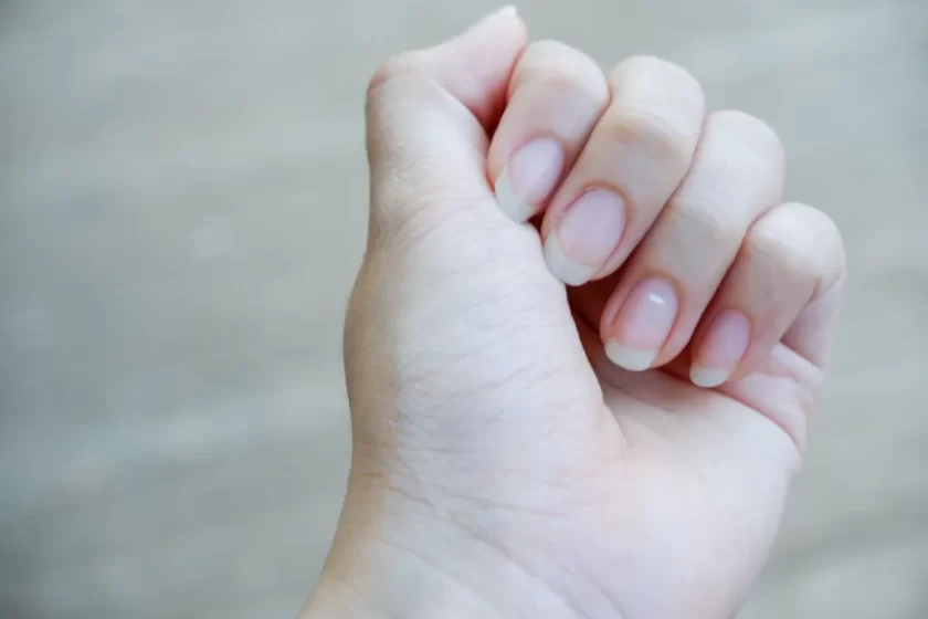 Cómo eliminar las manchas blancas de las uñas